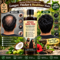 ORIGINAL ADIVASI HAKKI PIKKI HAIR Oil